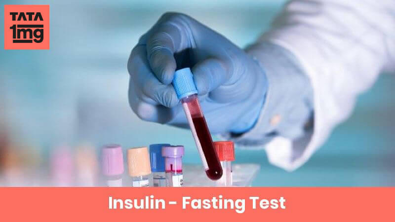 Insulin - Fasting (Insulin-F): Purpose & Normal Range of Results | 1mg